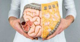 Darmkrebs - eine der häufigsten Krebserkrankungen bei Mann und Frau | apomio Gesundheitsblog