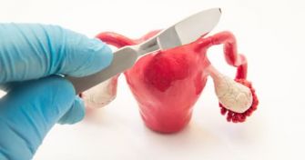 Wenn Frau kein Kind (mehr) bekommen möchte - Sterilisation | apomio Gesundheitsblog