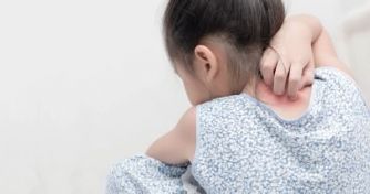 Achtung ansteckend! Was Eltern über Borkenflechte wissen sollten | apomio Gesundheitsblog