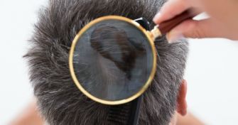 Seborrhoisches Ekzem: Welche Rolle spielt die Ernährung? | apomio Gesundheitsblog