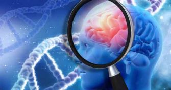 Wer mehr denkt, ist früher tot? Was ein hochaktives Hirn mit der Lebenserwartung zu tun hat | apomio Gesundheitsblog