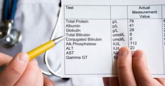 Warnsignal Gelbsucht: Anzeichen für eine Erkrankung von Leber oder Galle | apomio Gesundheitsblog