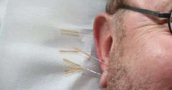 Ohrakupunktur - Anwendung und Wirkung | apomio Gesundheitsblog