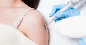 Für immer dein – oder doch vergänglich? Wie man Tattoos wieder los wird | apomio Gesundheitsblog