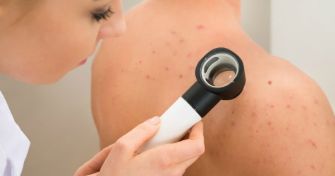 Furunkel: Bakterien sind die Ursache | apomio Gesundheitsblog