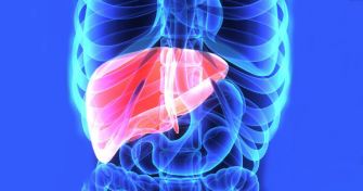 Hämochromatose: Wenn zu viel Eisen dem Körper schadet | apomio Gesundheitsblog