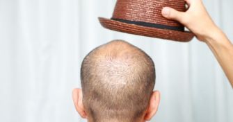 Hilfe! Ich habe Haarausfall | apomio Gesundheitsblog