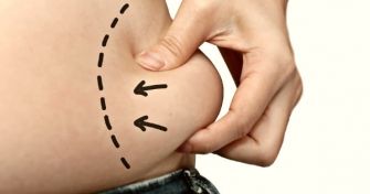 Körperfettanteil: Wie viel Körperfett ist normal? | apomio Gesundheitsblog