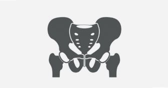 Führen Leistenschmerzen automatisch zum Leistenbruch? | apomio Gesundheitsblog