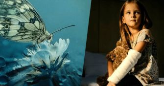 Die Schmetterlingskrankheit: Ein leichter Name für ein schweres Schicksal | apomio Gesundheitsblog