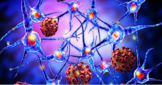 Tuberkulose: Was es heute mit der Krankheit auf sich hat | apomio Gesundheitsblog