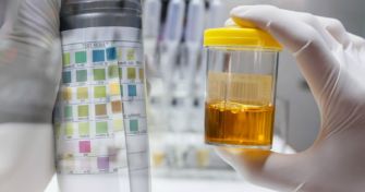 Was der Urin über unsere Gesundheit verrät | apomio Gesundheitsblog