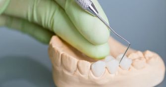 Zahnersatz – Was zahlt die Kasse und was nicht? | apomio Gesundheitsblog